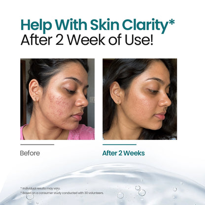 Brightening Face Serum with 5% Nano Niacinamide and 2% Alpha Arbutin | For All Skin Types